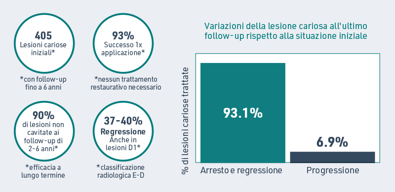 Grafico follow-up della lesione cariosa