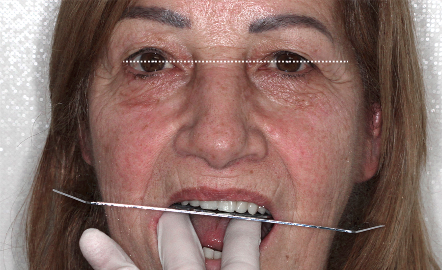 extra-orale macro del sorriso