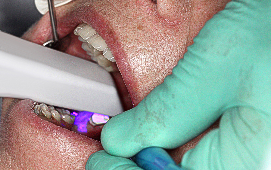 Foto durante la scansione pre-chirurgica