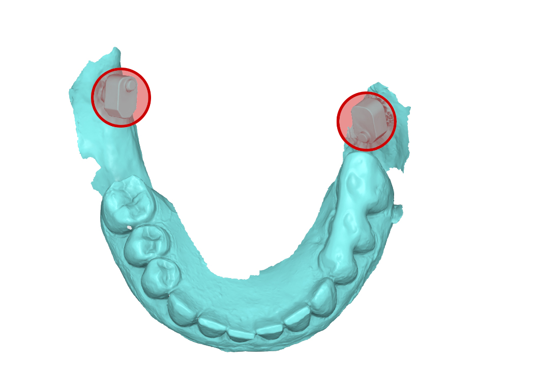file .stl dell’impronta inferiore