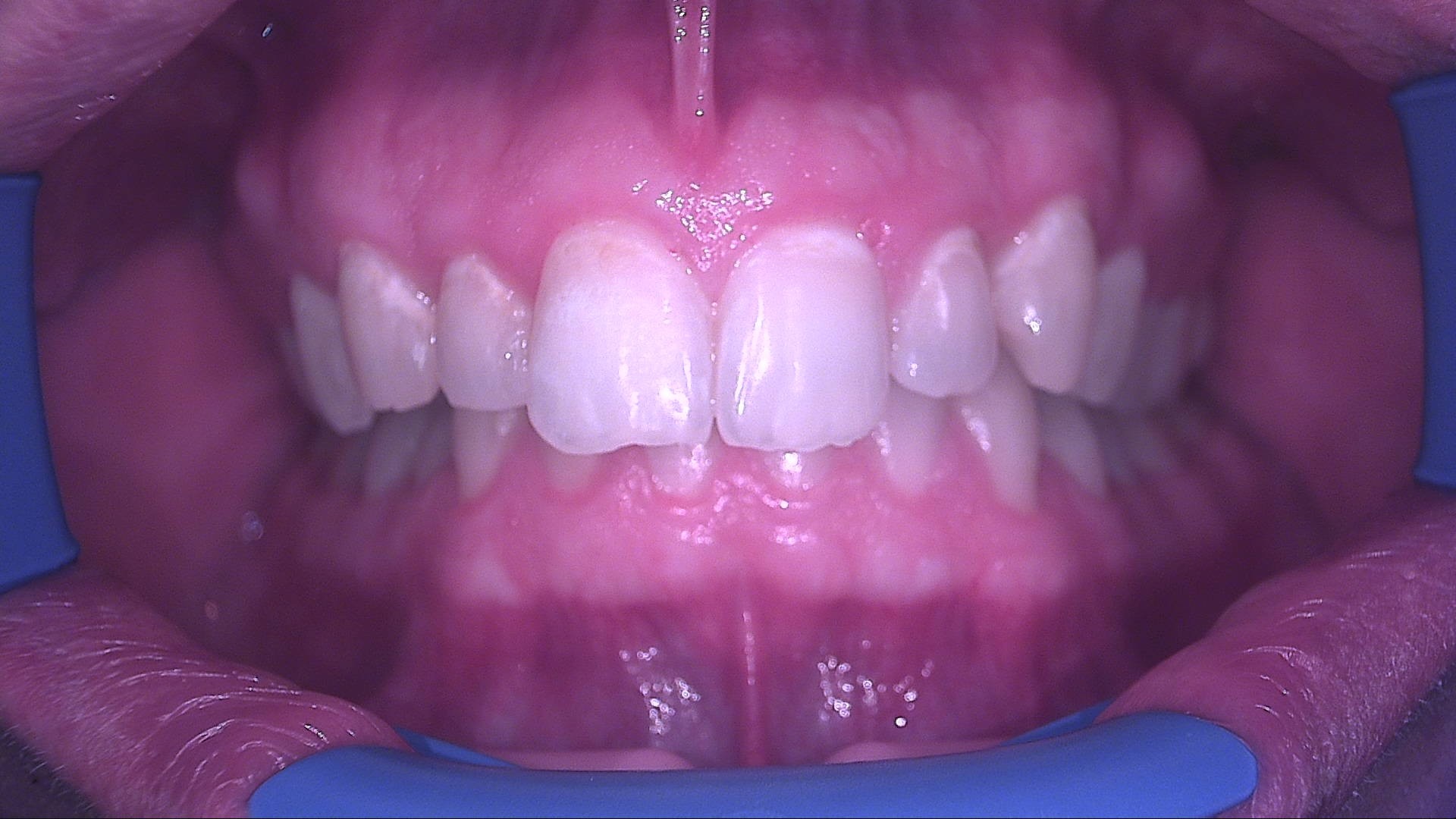 Situazione iniziale in luce bianca