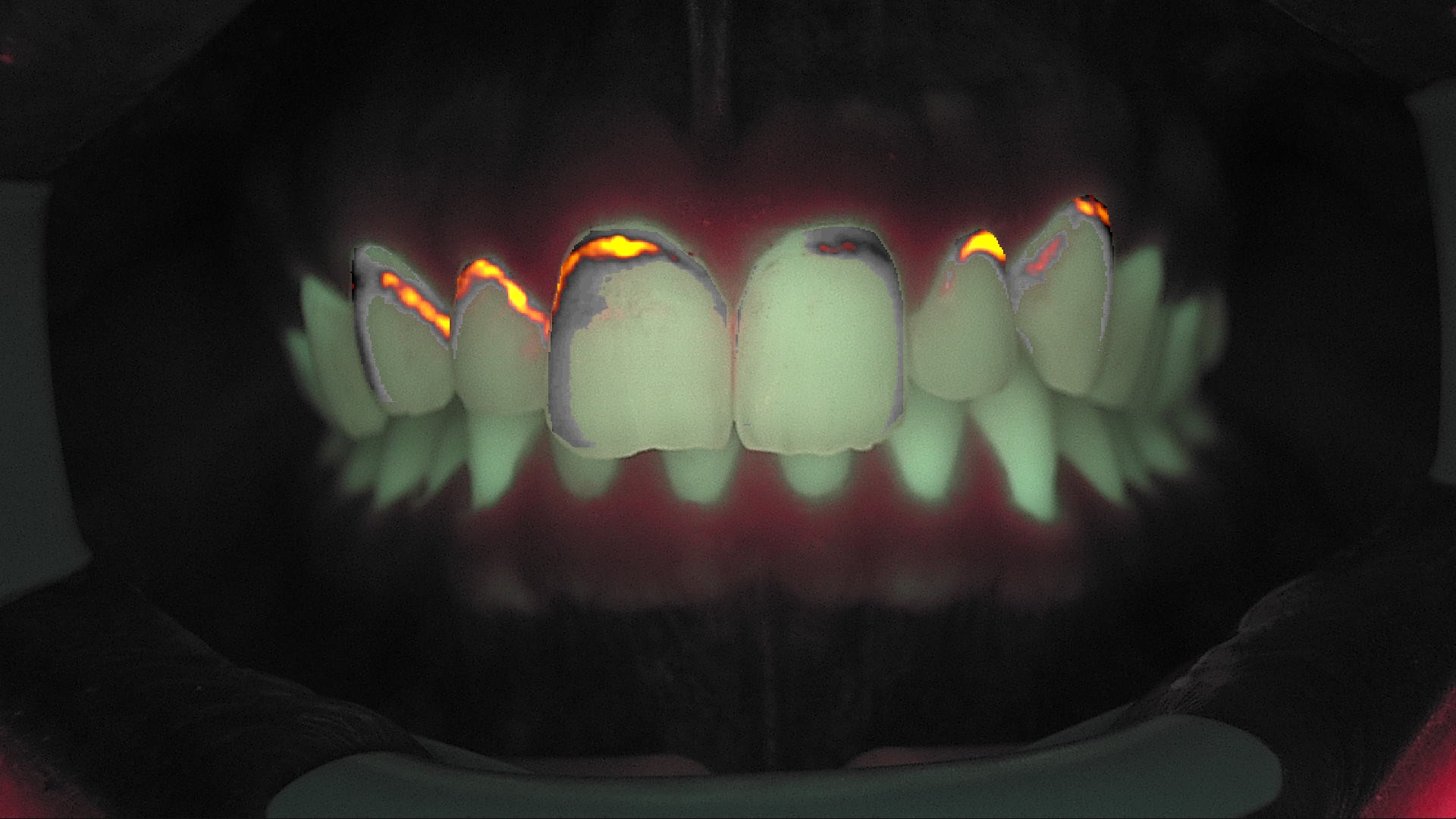 Fluorescenza pre-trattamento