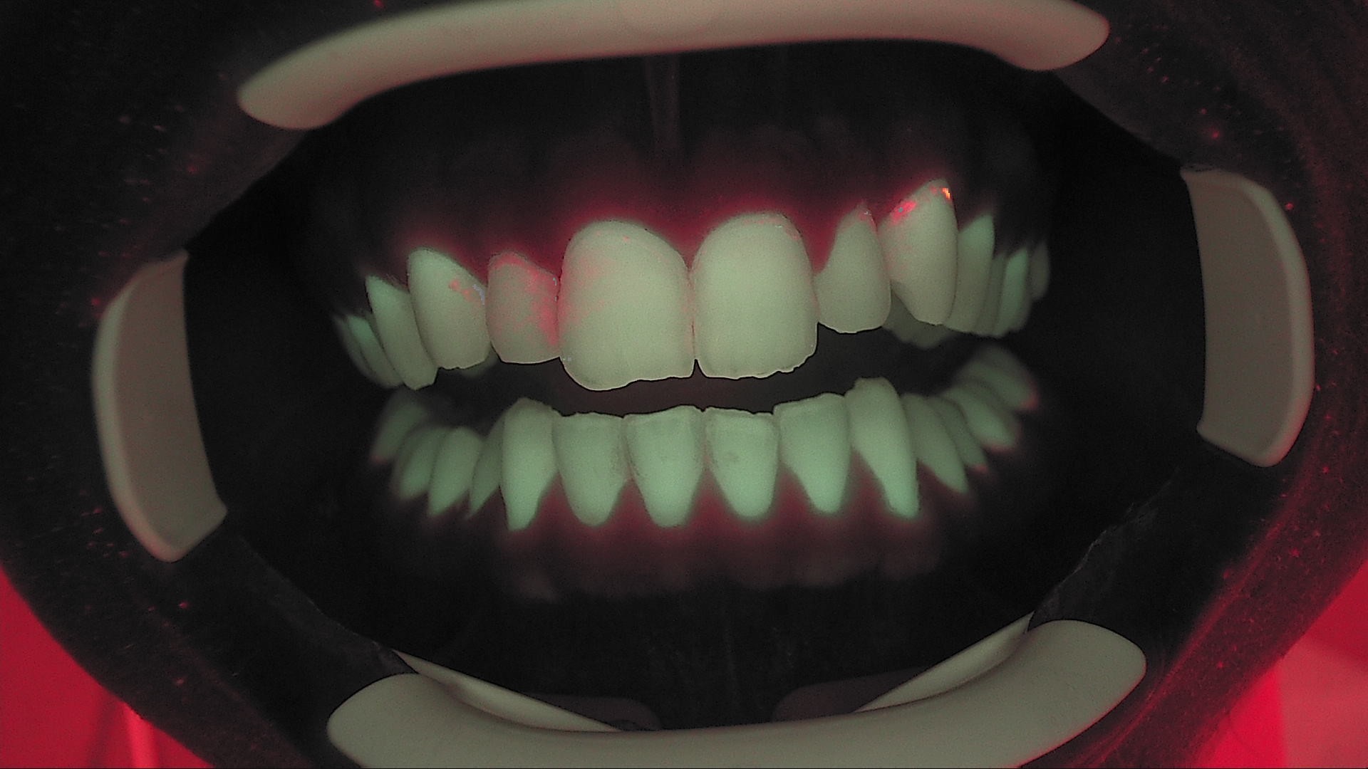 Fluorescenza a un mese