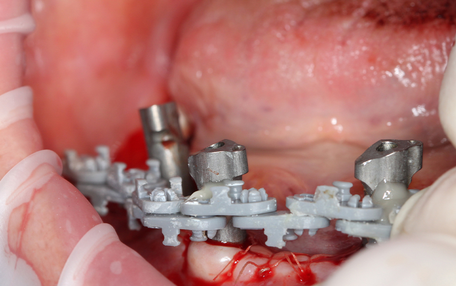 Foto della dima universale di scansione