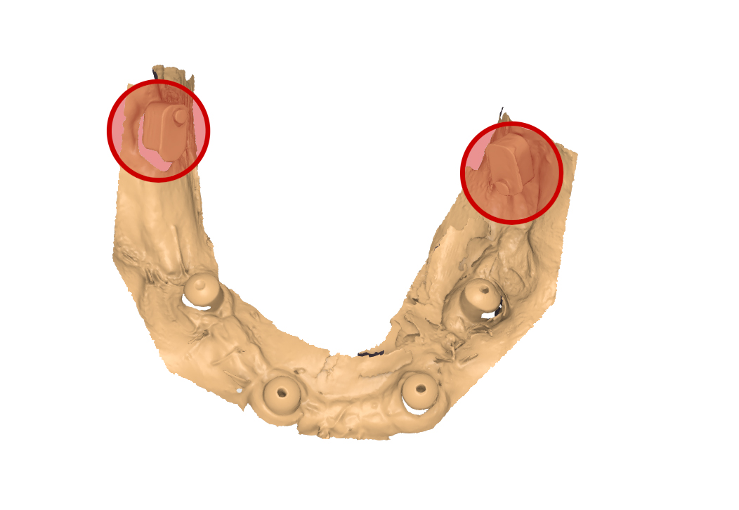 file .stl dell’impronta inferiore delle mucose