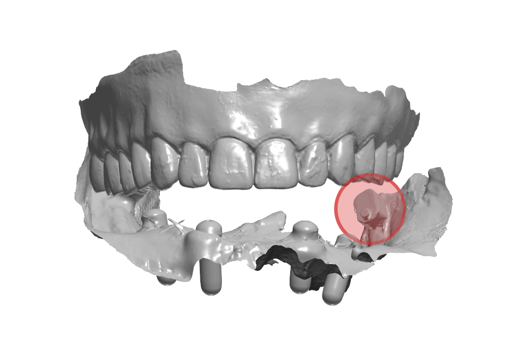 Arcate scansionate all’interno dell’articolatore digitale