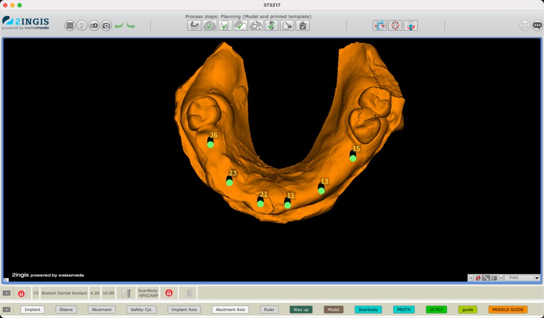 Preparazione del caso 2