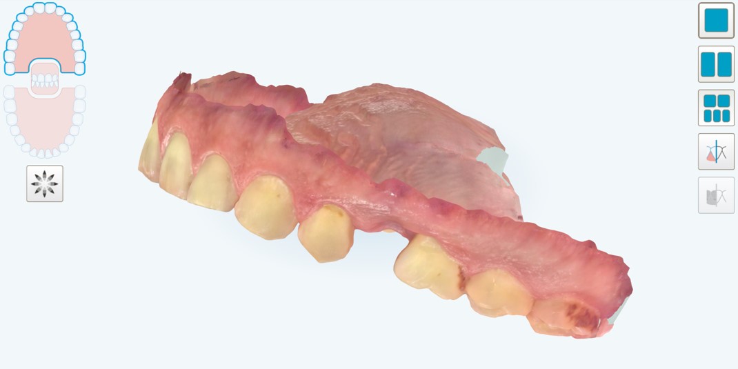 Situazione pre-operatoria, visione laterale