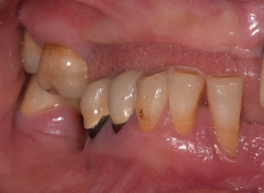 Situazione pre operatoria 1