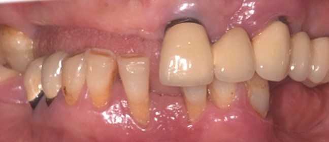 Situazione pre operatoria 2