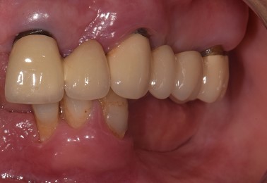 Situazione pre operatoria 3