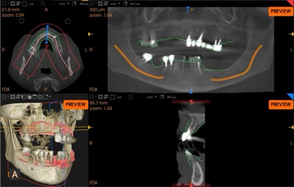 Situazione pre operatoria 4