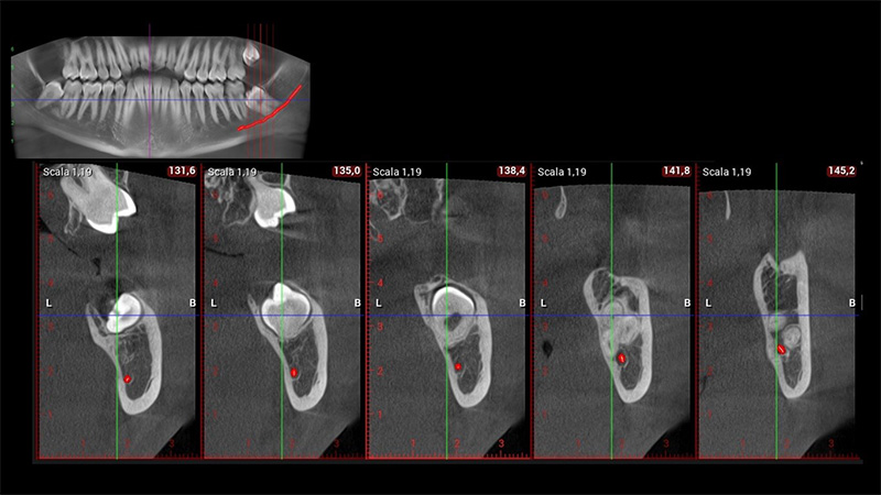Visualizzazione "Dental Scan"