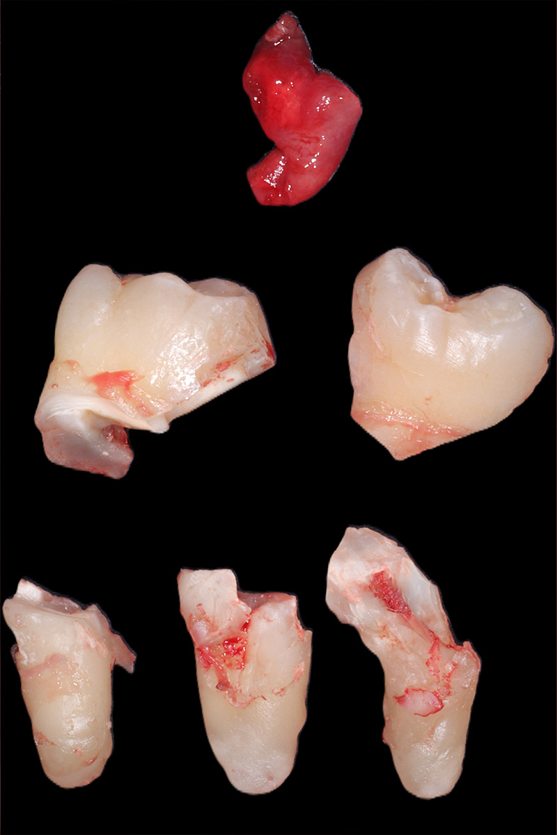 Elemento 3.8 estratto