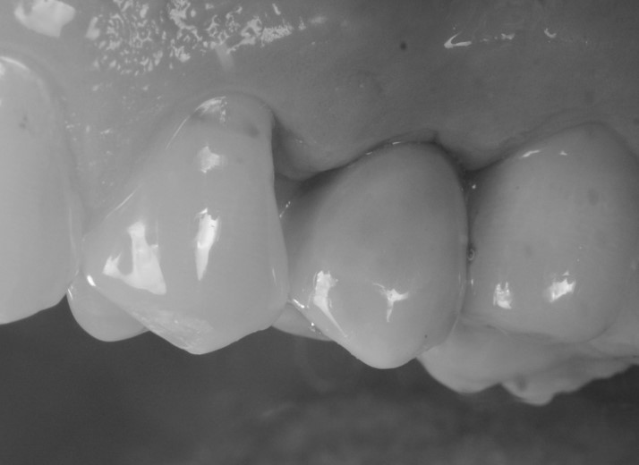 Consegna del restauro, visione laterale