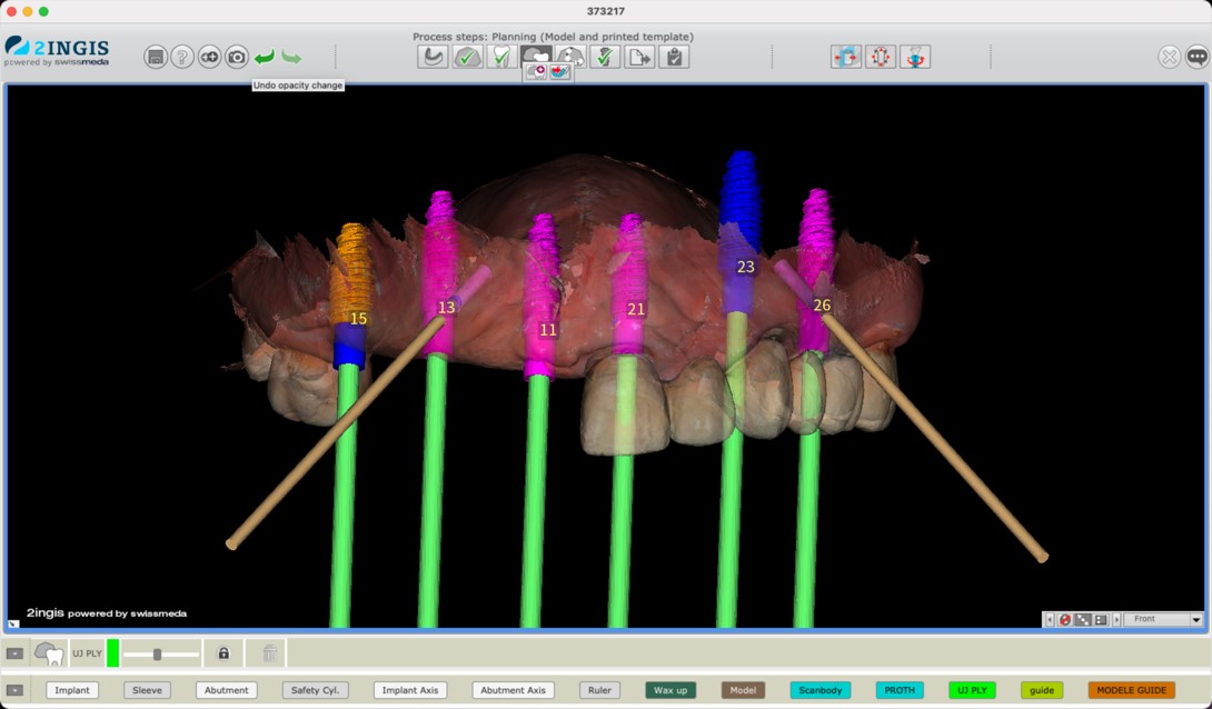 Pianificazione del caso