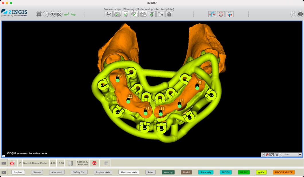 Preparazione del caso 3