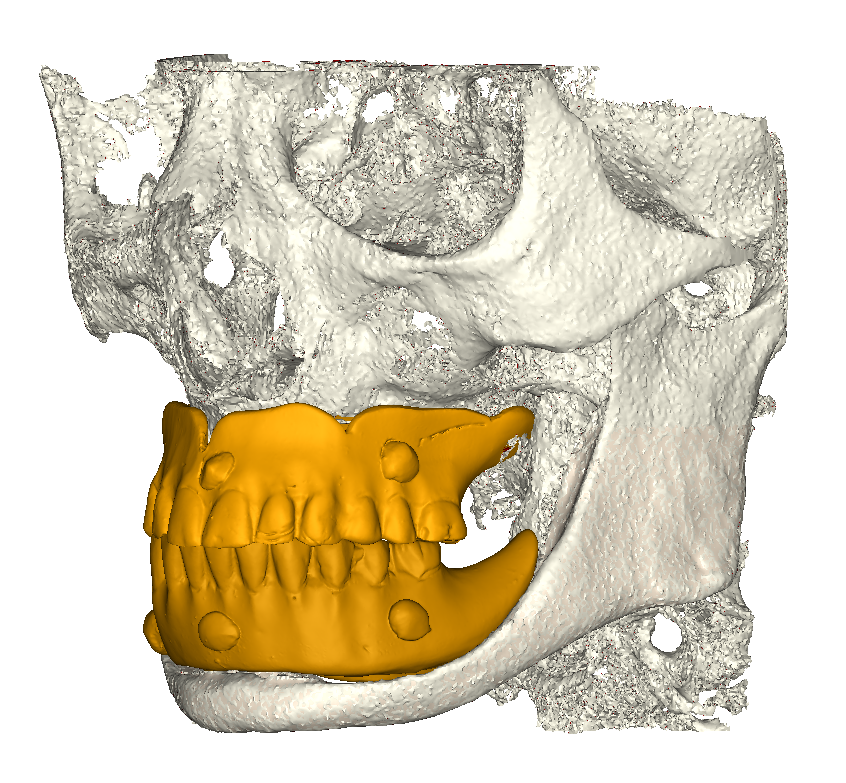 Dime radiologiche in posizione
