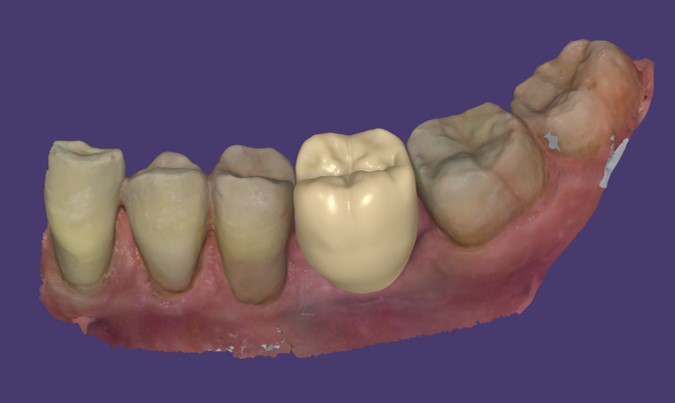 rendering fotorealistico