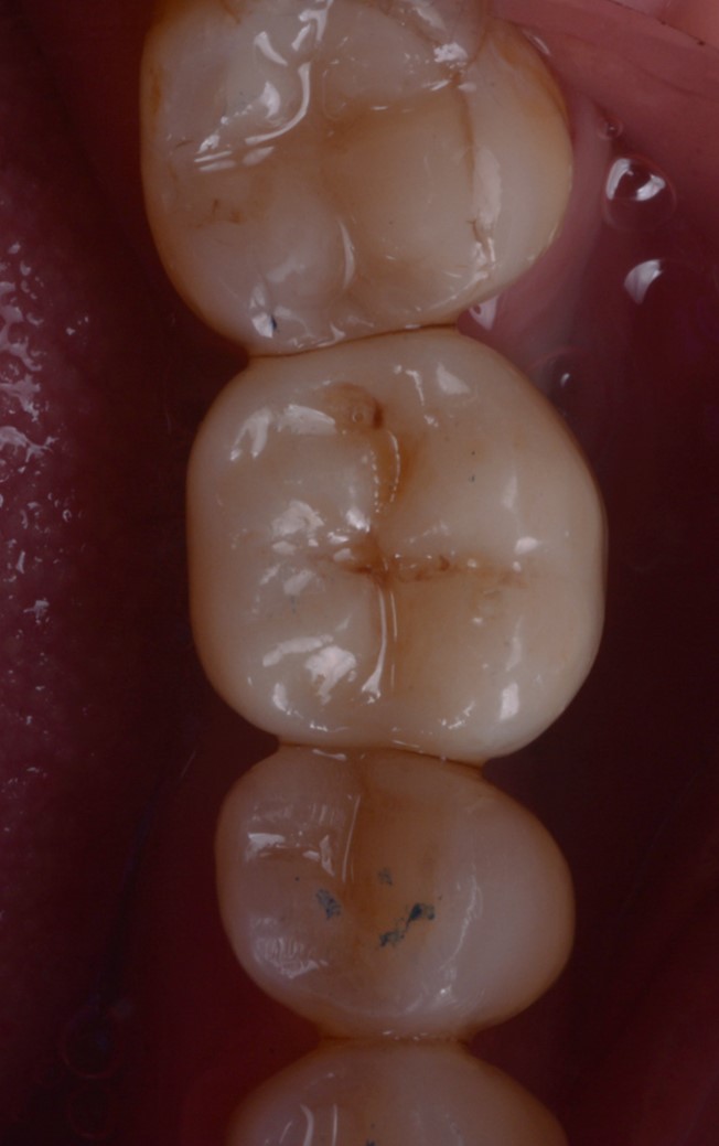 consegna del restauro