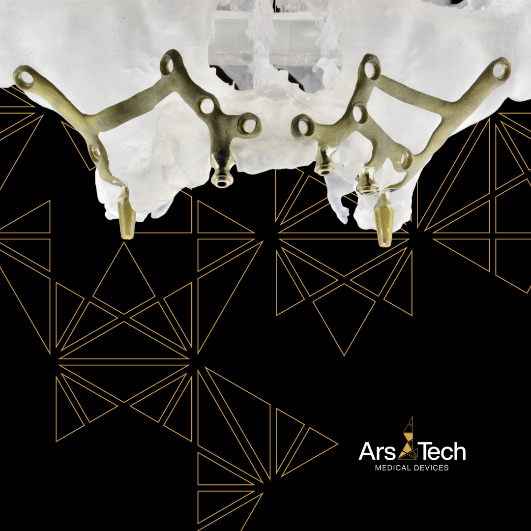 Impianto iuxta con connessioni MUA.