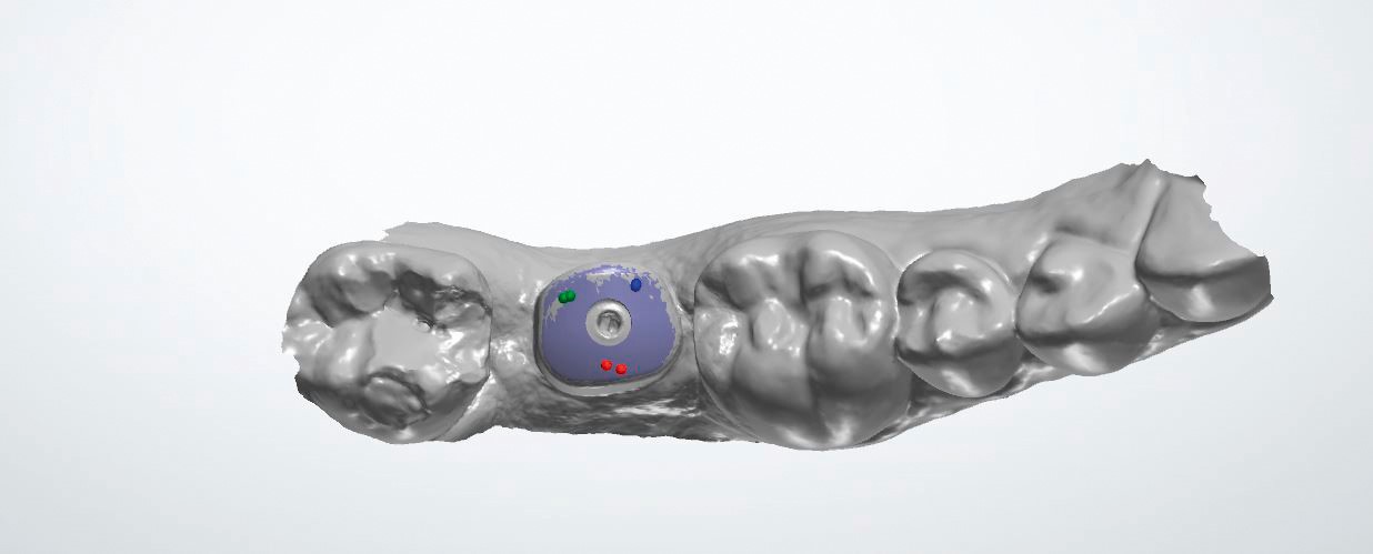 Esempio pratico di iPhysio® in software di CAD.