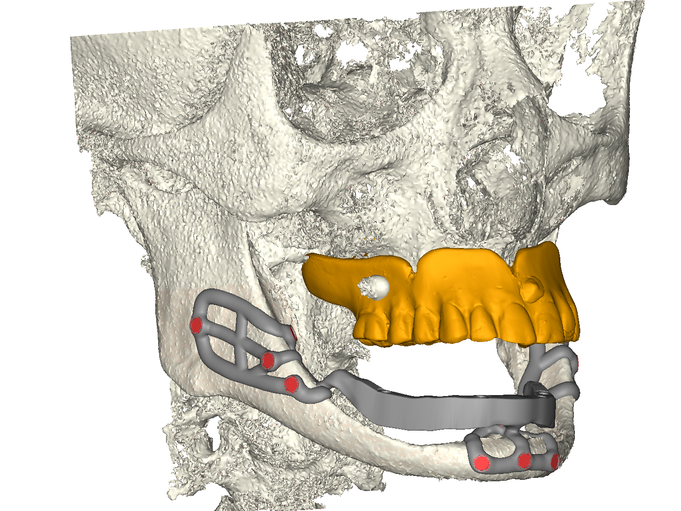 Progetto iuxta tripodale