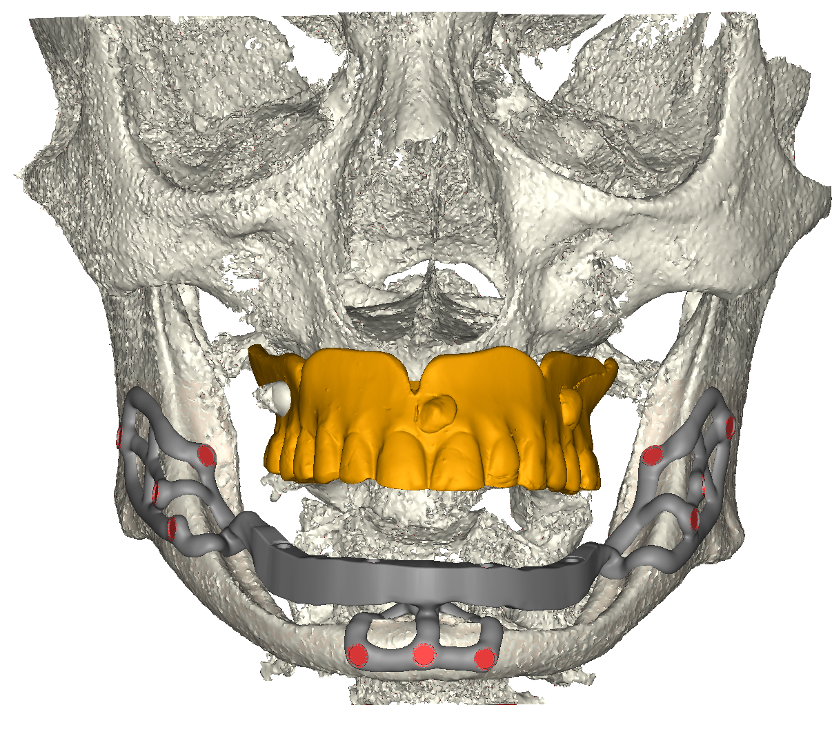 Vista frontale iuxta in posizione