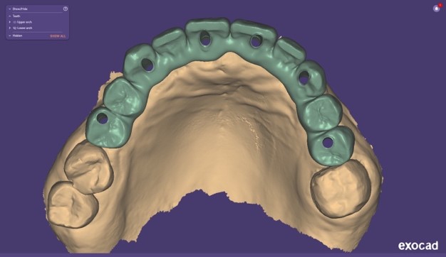 Progetto CAD finale 2