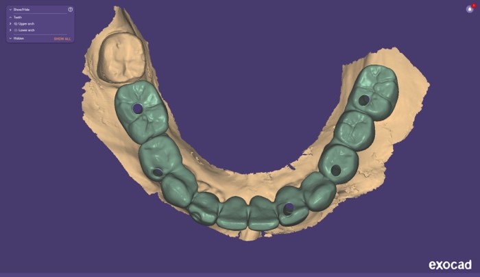 Progetto CAD finale 3