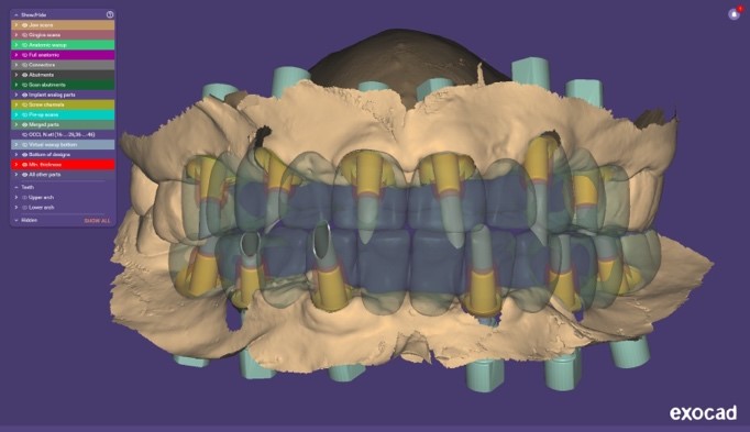 Progetto CAD finale 4
