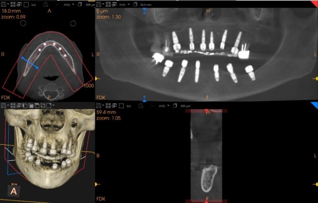 Progetto CAD finale 5