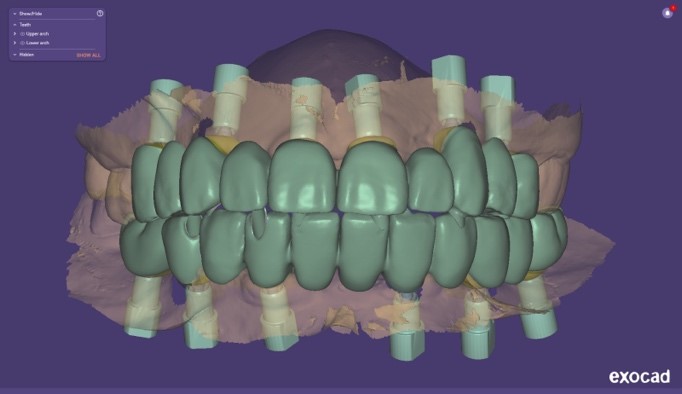 Progetto CAD finale 6