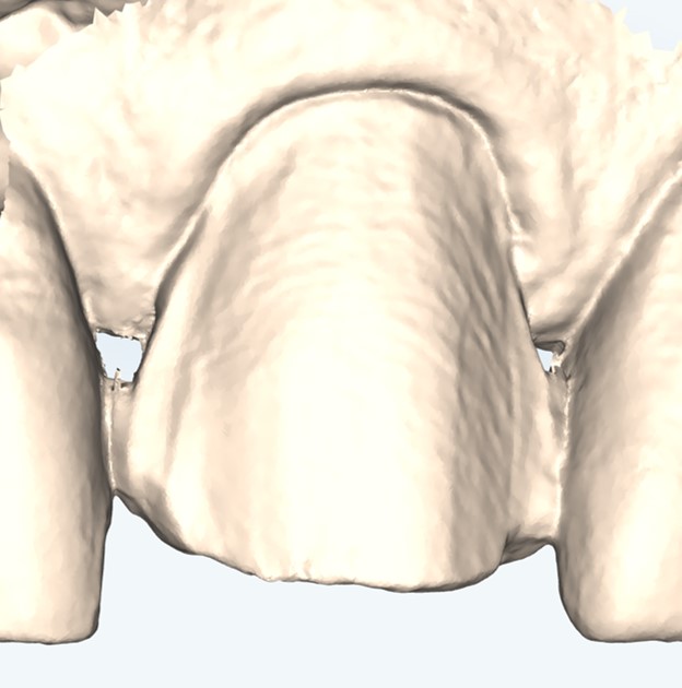 dettaglio acquisizione