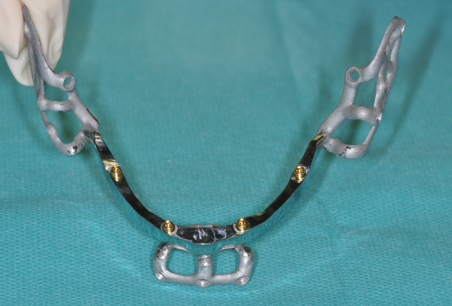 Il dispositivo iuxta osseo tripodale