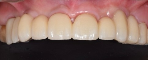 Il restauro definitivo alla consegna