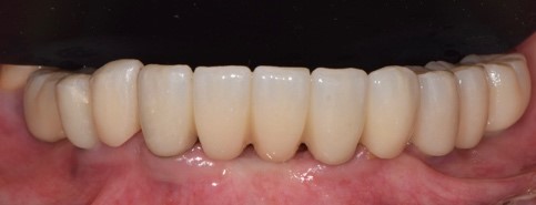 Il restauro definitivo alla consegna 2