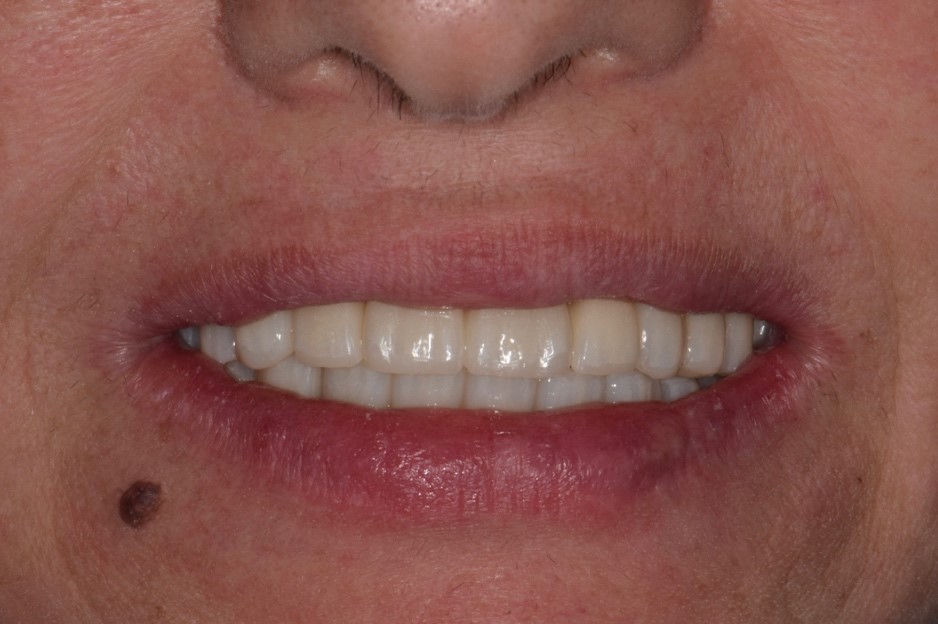 Il restauro definitivo alla consegna 6