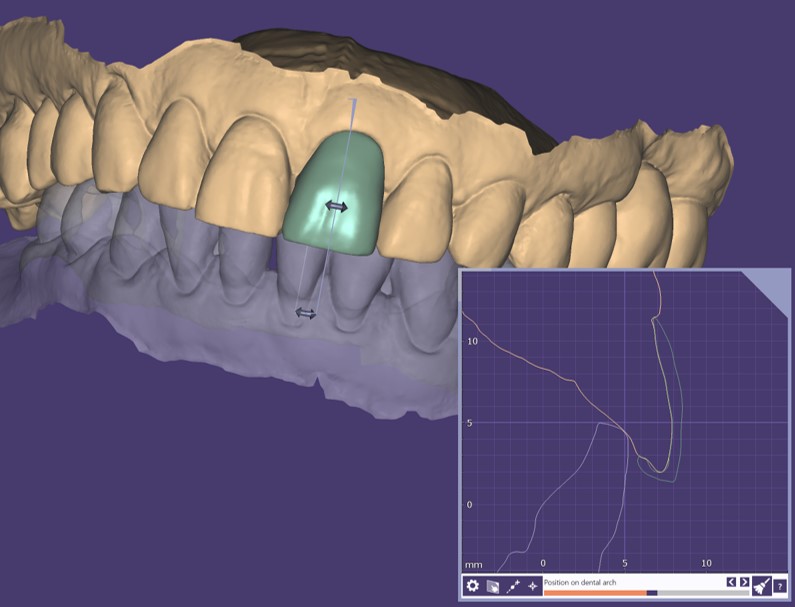 particolare del modellato