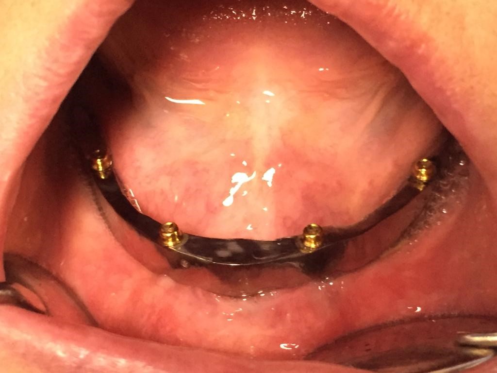 Guarigione dei tessuti