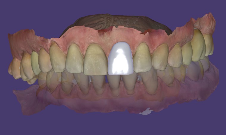 rendering della modellazione