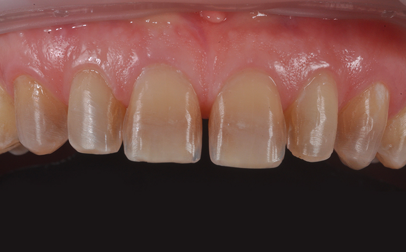 preparazioni VertiCAD