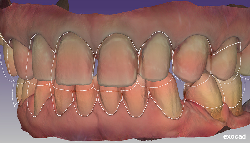 preparazioni definitive