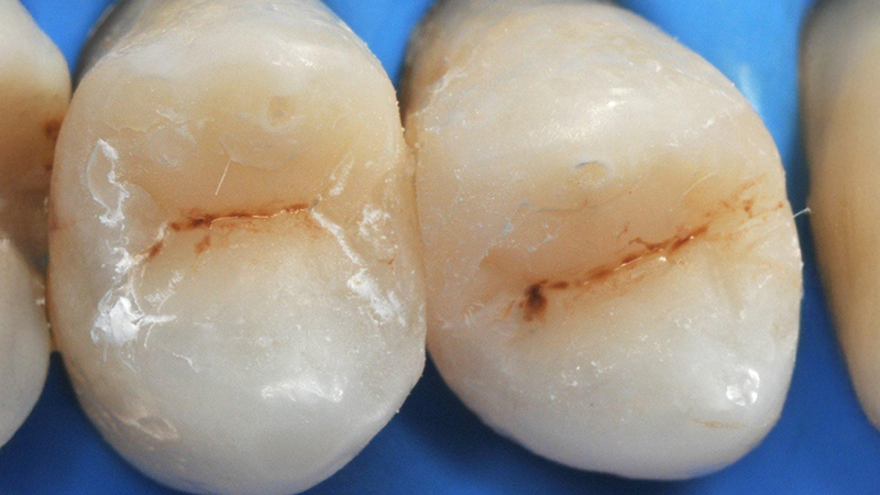 applicazione delle caratterizzazioni per completare i restauri