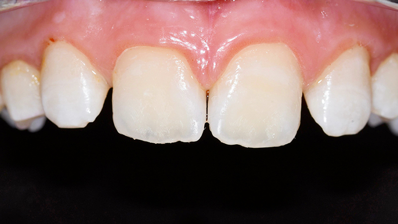 miglioramento estetico