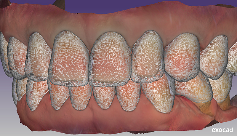 preparazioni definitive