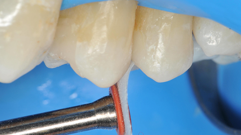 rifiniture dei restauri