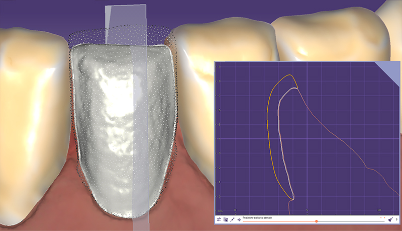 cut view morfologia gengivale