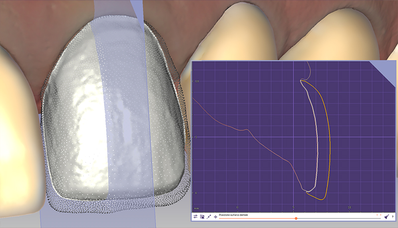 cut view morfologia gengivale