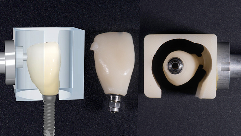 Dente fresato in PMMA